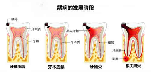 图片14.jpg 图片14.jpg