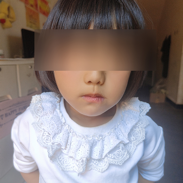 002康复后面容.jpg 002康复后面容.jpg