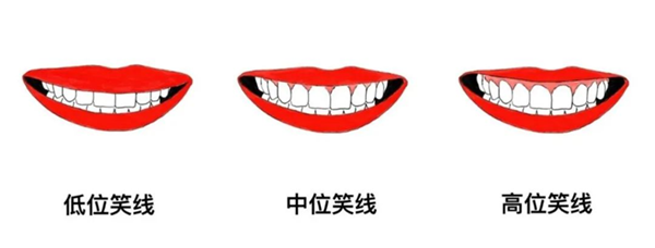 4 (1).png 4 (1).png