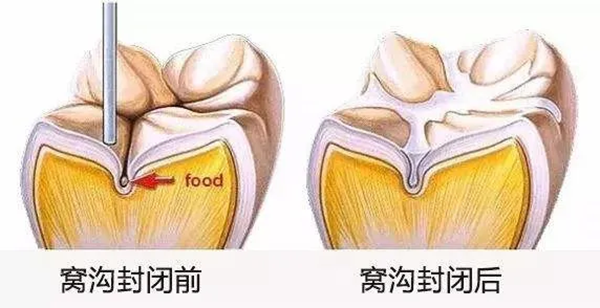 2.png 2.png