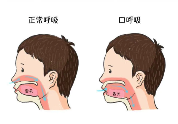 图片 8.png 图片 8.png
