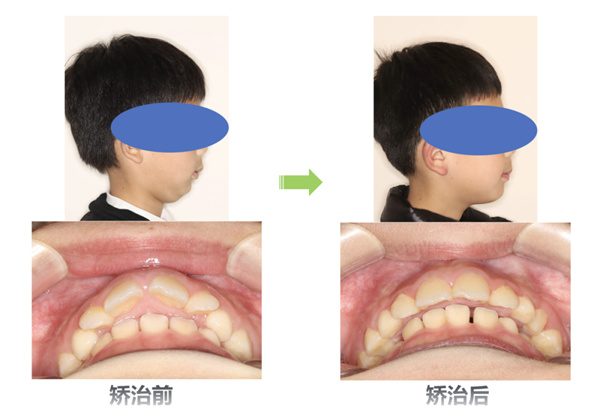 图片 22.jpg 图片 22.jpg