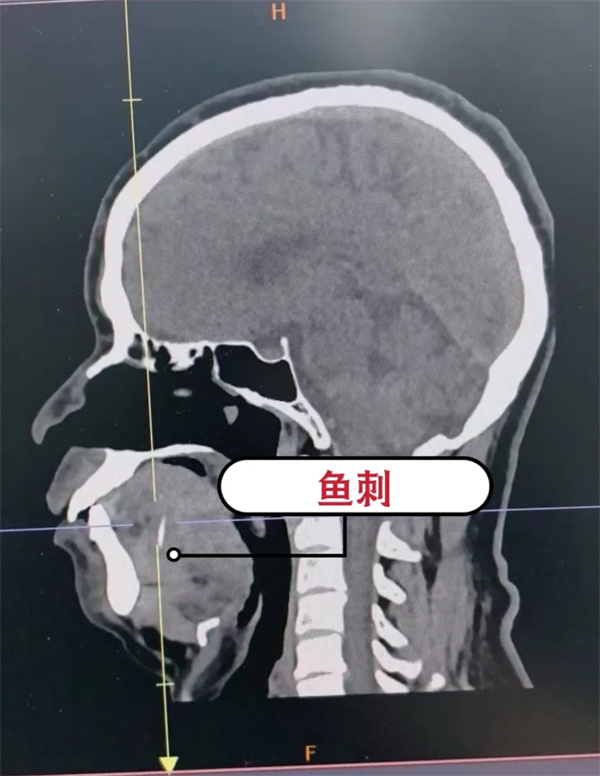 图片 44.jpg 图片 44.jpg