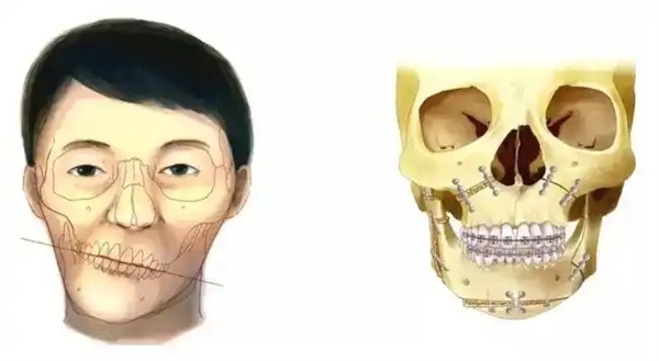 图片 85.jpg 图片 85.jpg